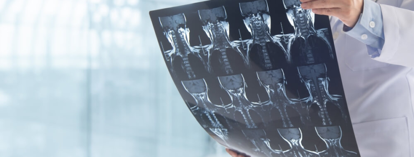 The Importance of Documentation in Electrical Lineman Injury Claims